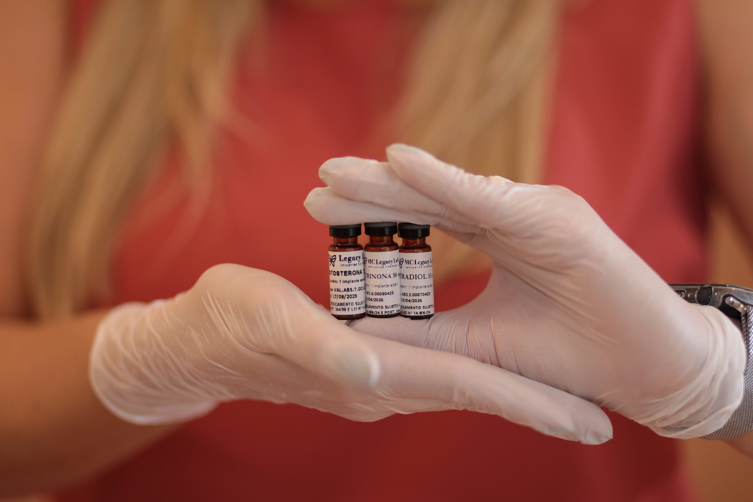 Implantes hormonais feminino – equilíbrio e saúde